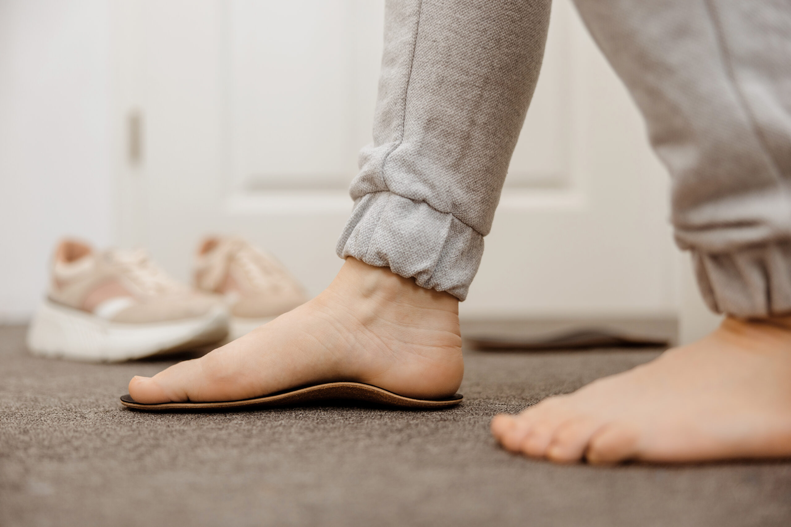 Flat feet diagnosis and orthotics, shoe inserts. Problems with flatfoot, pain. Identification of flat foot. Treatment to plantar fasciitis. Womans foot and insoles at home, close up view.